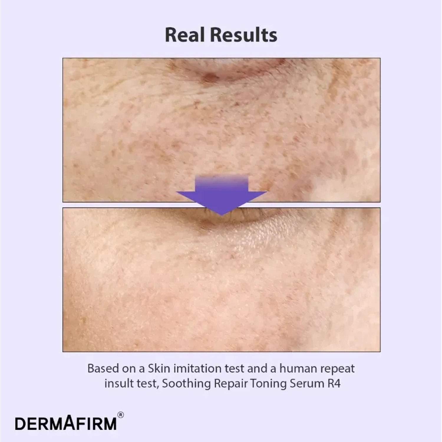 Мультифункціональна сироватка з бакучіолом Dermafirm Soothing Repair Toning Serum