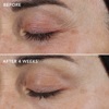 Восстанавливающий крем с ретиноловым комплексом 0.3% IMAGE Ageless+ Retinol Repair Crème 0.3%