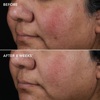 Концентрат чистого ретинола 0,75% IMAGE Ageless+ Retinol Pure Liquid Retinol 0,75%