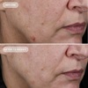 Концентрат чистого ретинола 0,75% IMAGE Ageless+ Retinol Pure Liquid Retinol 0,75%