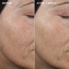 Концентрат чистого ретинола 0.3% IMAGE Ageless+ Retinol Pure Liquid Retinol 0.3%