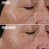 Концентрат чистого ретинола 0.1% IMAGE Ageless+ Retinol Pure Liquid Retinol 0.1%