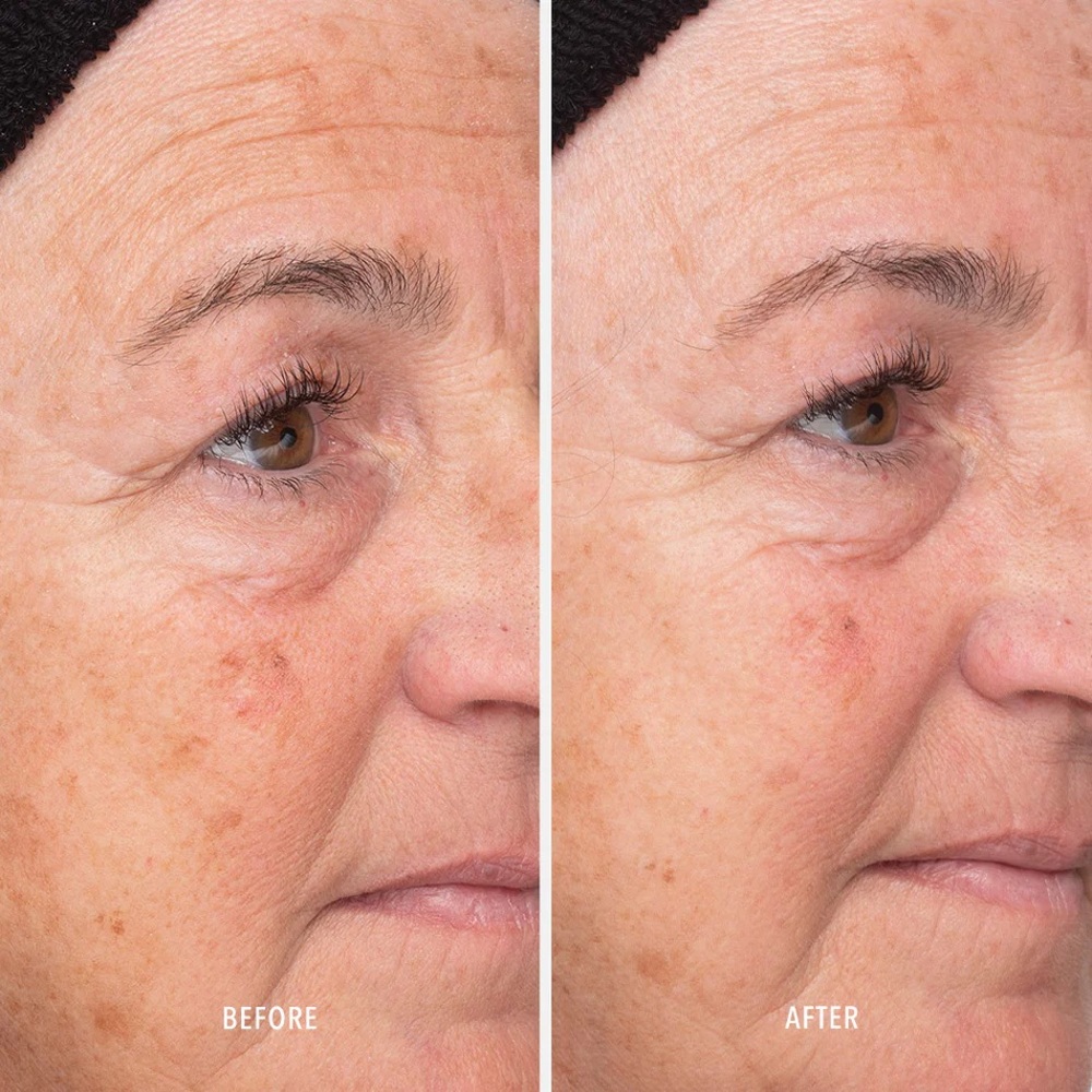 HydroPeptide Liquid Resurfacing Solution — лосьон-эксфолиант