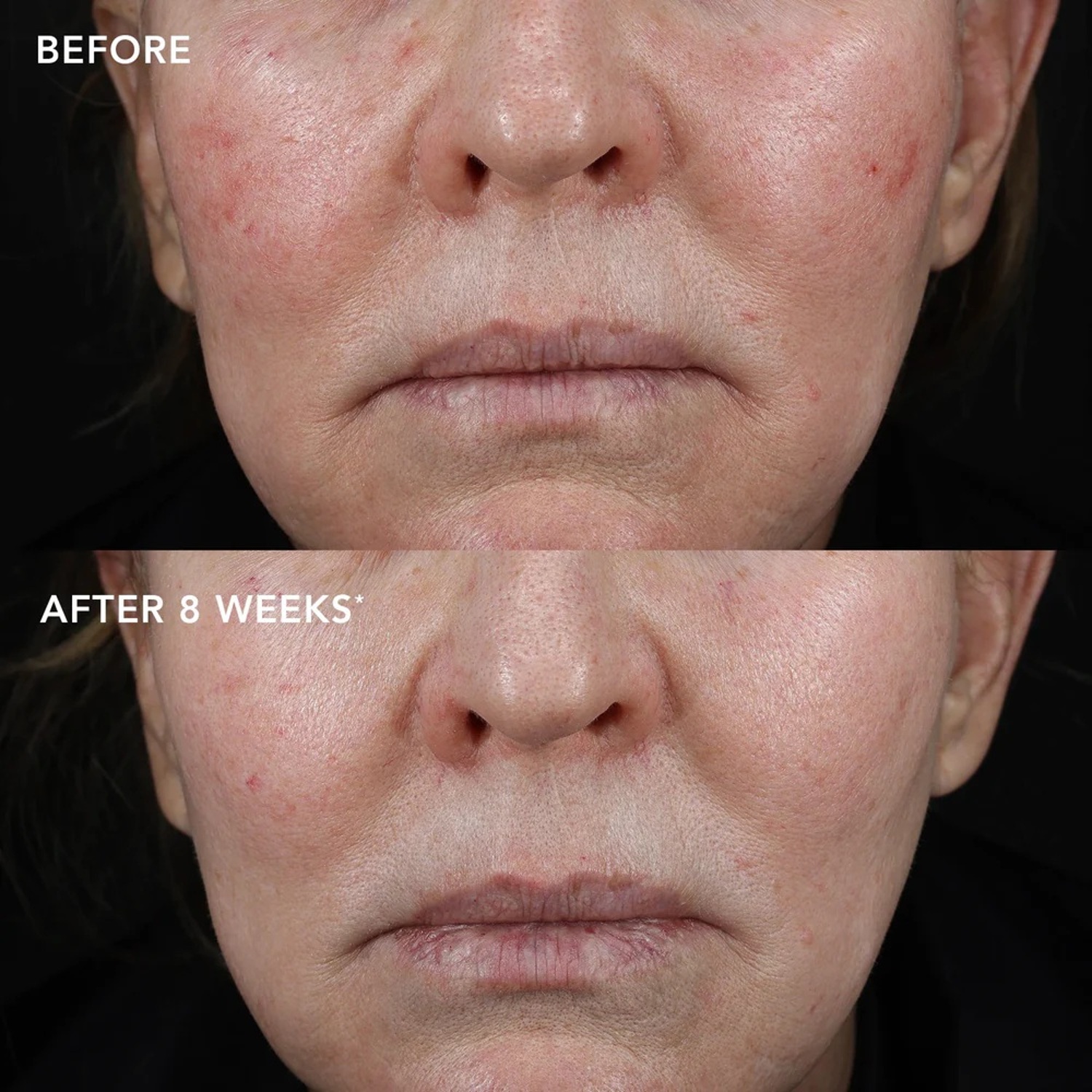 Биотехнологический крем с экзосомами для поддержания долголетия IMAGE MD® Biotech Longevity Creme