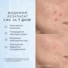 Пептидна сироватка з 10% ніацинаміду Medik8 10% Niacinamide Peptides
