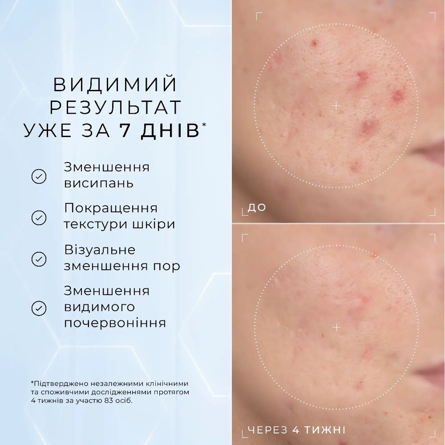 Пептидна сироватка з 10% ніацинаміду Medik8 10% Niacinamide Peptides