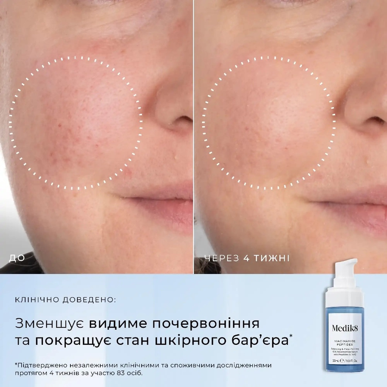 Пептидна сироватка з 10% ніацинаміду Medik8 10% Niacinamide Peptides
