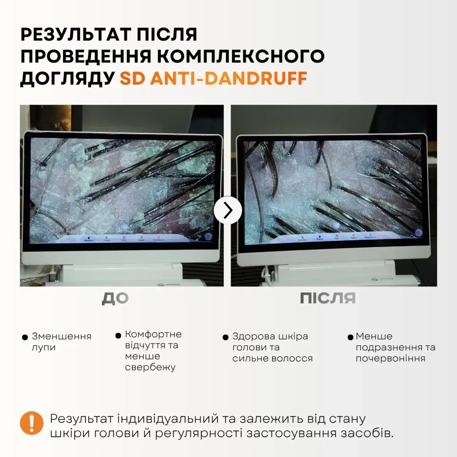 Лосьйон для шкіри схильної до лупи FULL FORCE SD ANTI-DANDRUFF Scalp Lotion