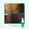 Лосьйон для стимуляції росту волосся Neofollics Hair Growth Stimulating Lotion