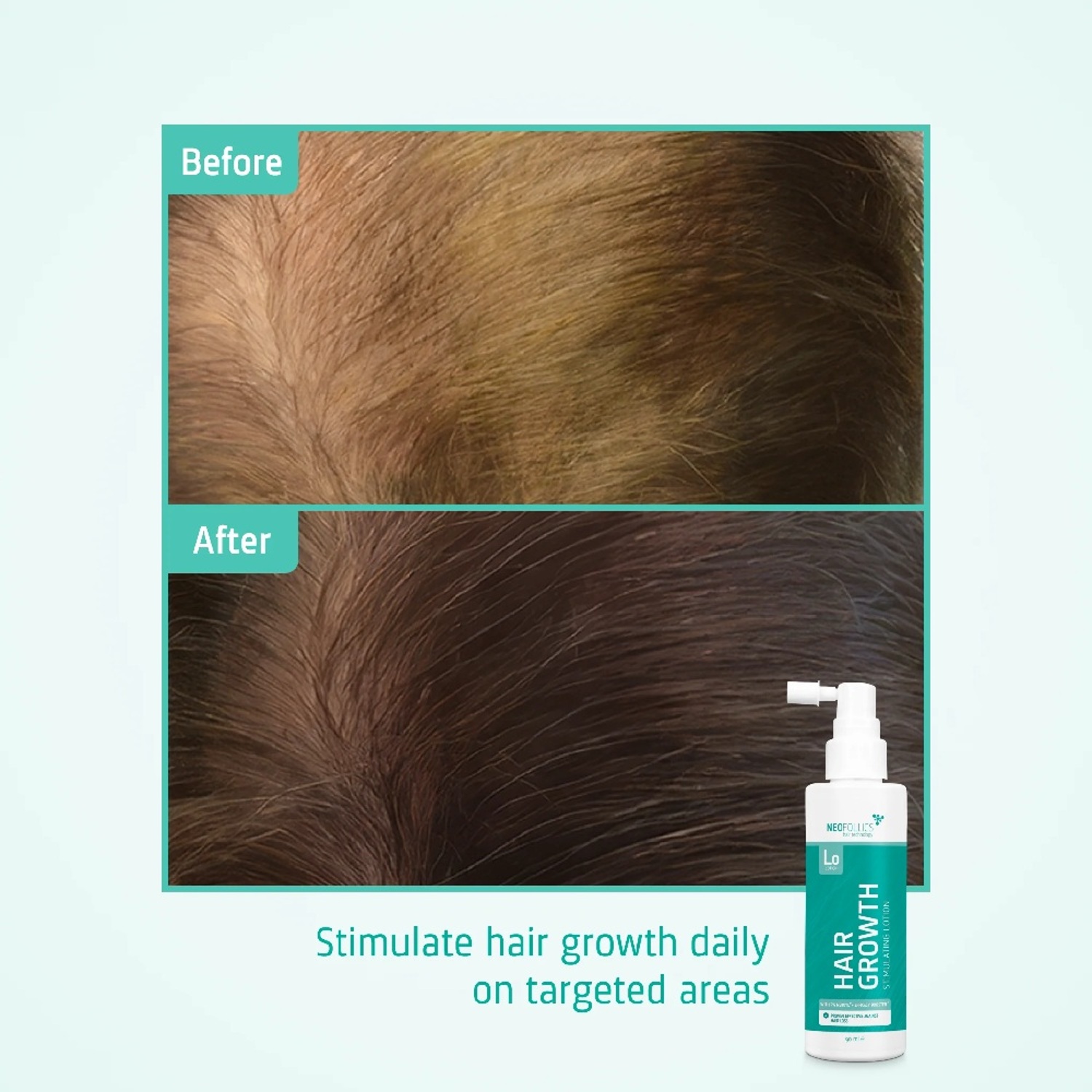 Лосьйон для стимуляції росту волосся Neofollics Hair Growth Stimulating Lotion
