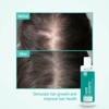 Шампунь для стимуляции роста волос Neofollics Hair Growth Stimulating Shampoo