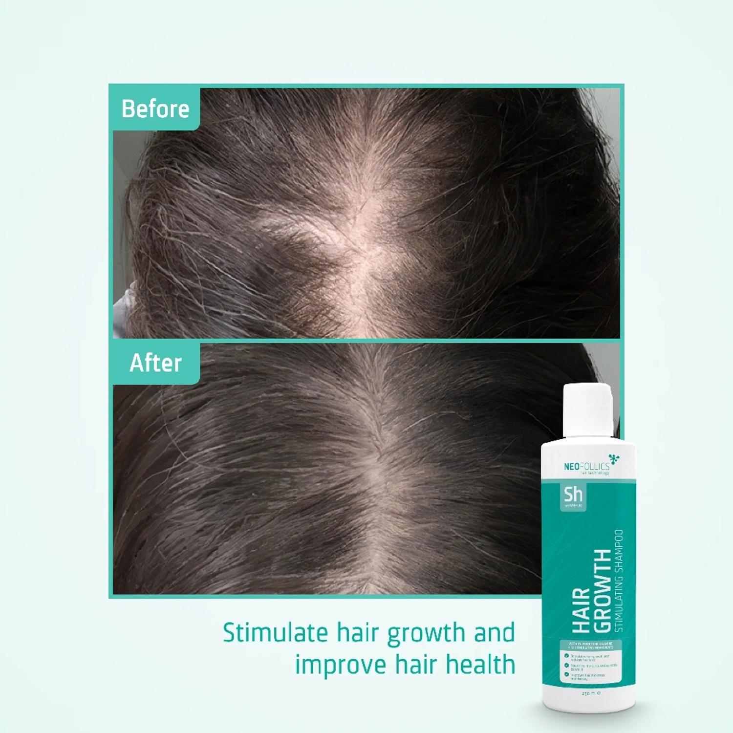 Шампунь для стимуляции роста волос Neofollics Hair Growth Stimulating Shampoo