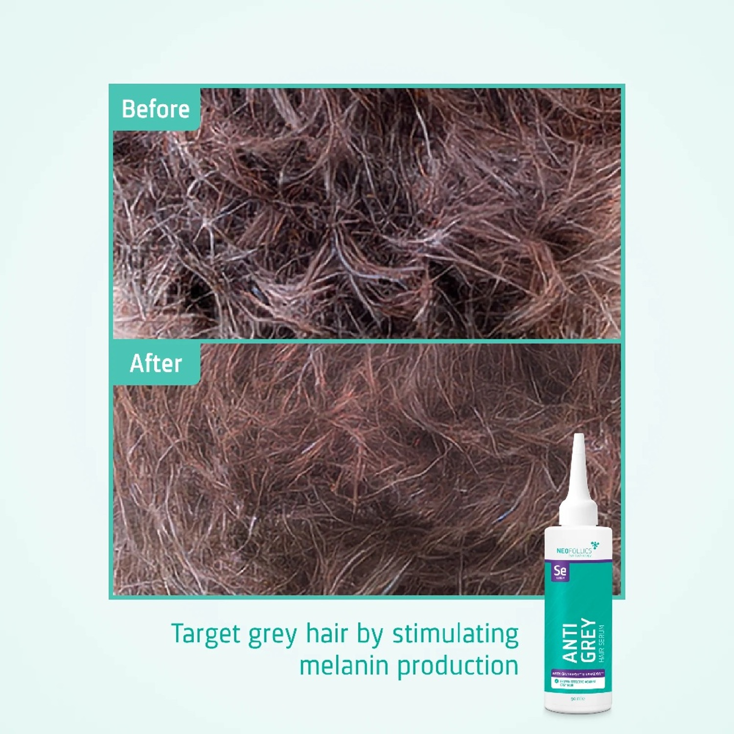 Сироватка для попередження появи сивини Neofollics Anti Grey Hair Serum