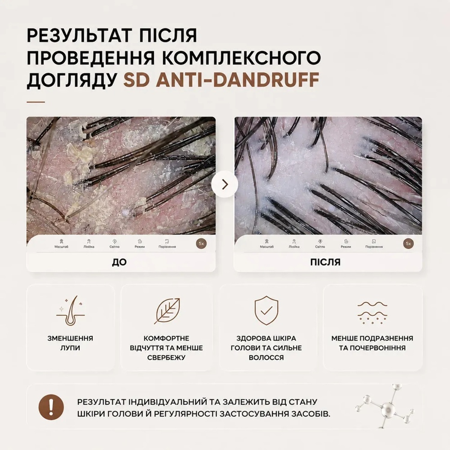 Шампунь для кожи склонной к перхоти FULL FORCE SD ANTI-DANDRUFF Hair Shampoo