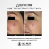 Судинозміцнююча сироватка для чутливої та реактивної шкіри AG SKIN Anti-Redness Serum