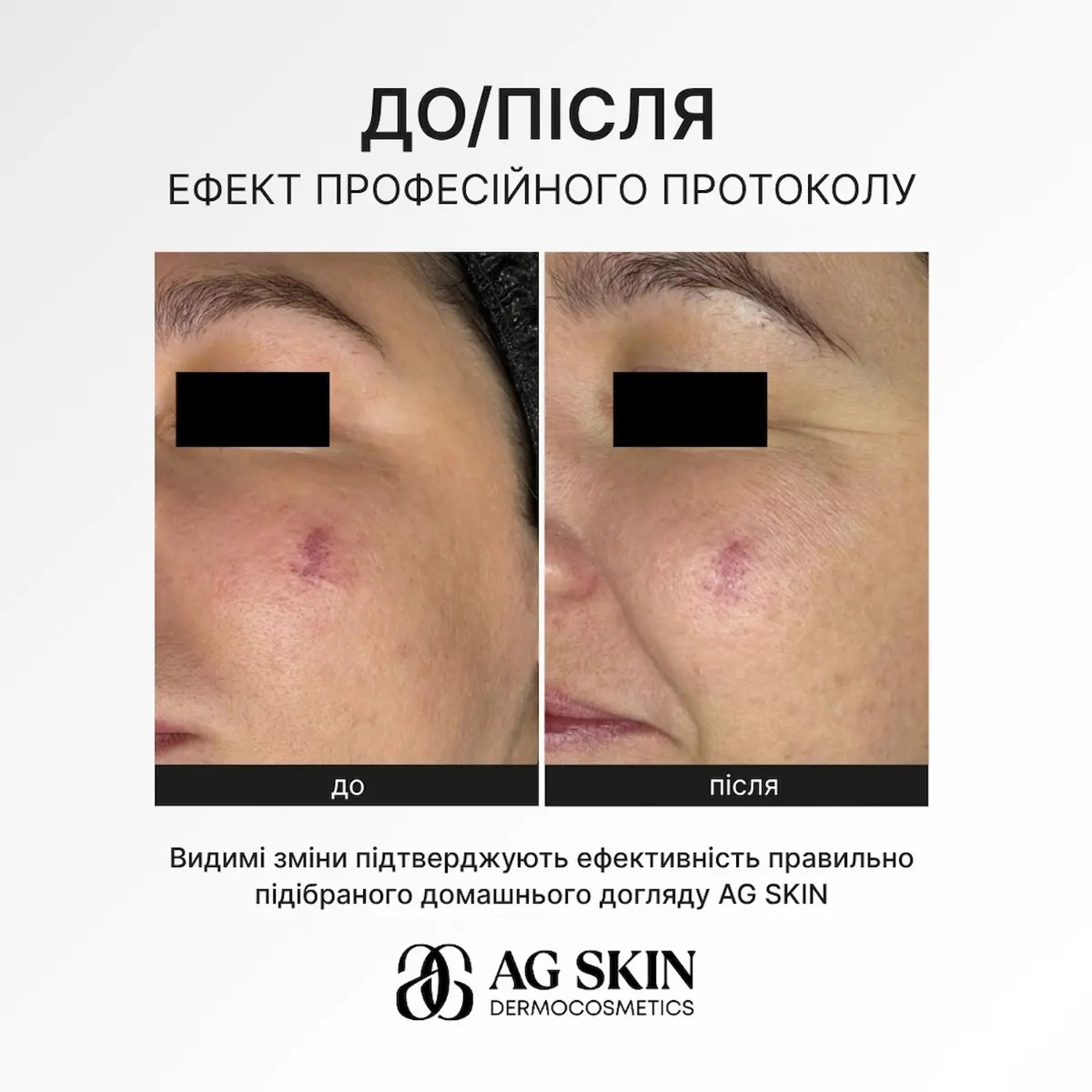 Судинозміцнююча сироватка для чутливої та реактивної шкіри AG SKIN Anti-Redness Serum